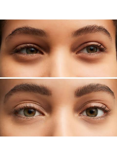 Right Image